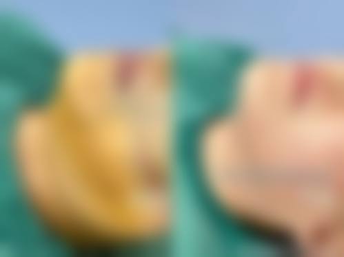 求美者真实反馈