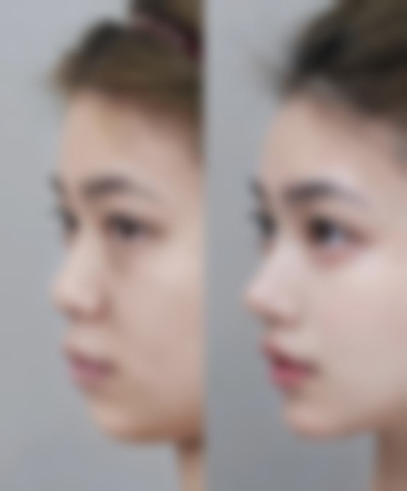 求美者真实反馈