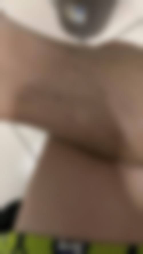 求美者真实反馈