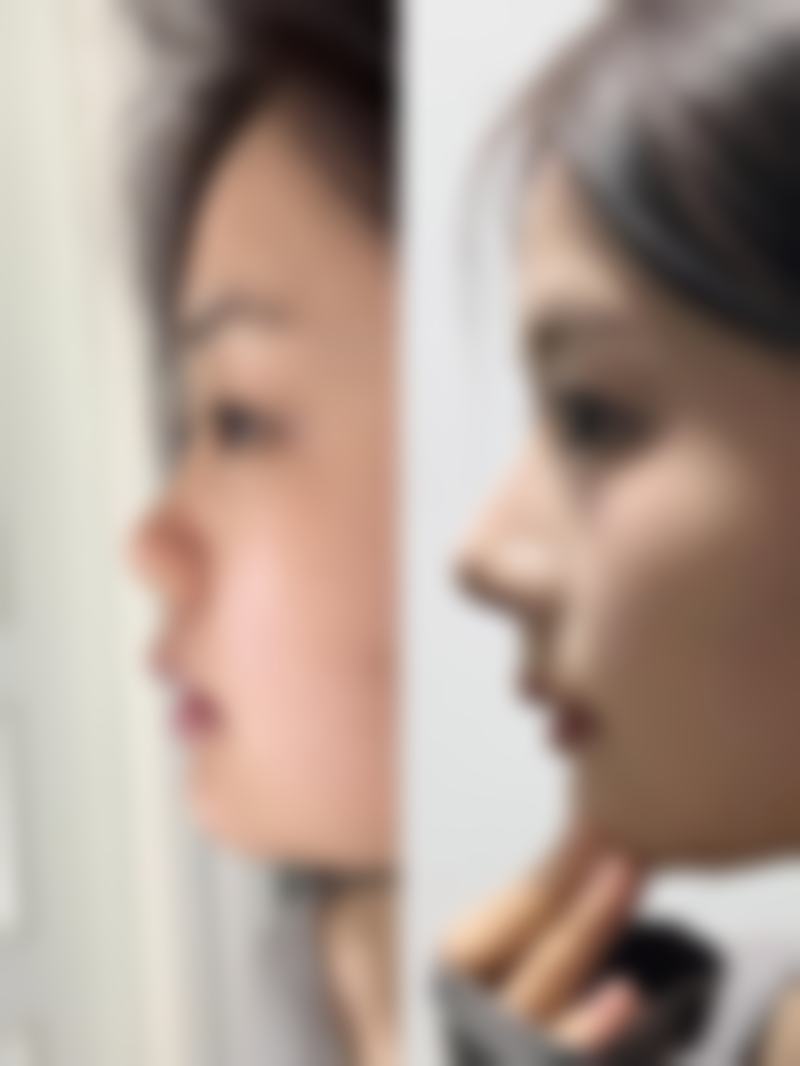 张赫医生可使用的精良医美技术支持