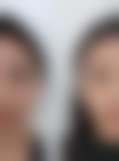 张赫医生可开展的核心医美项目范畴