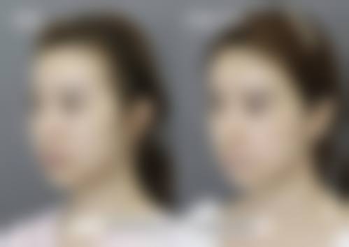 求美者真实反馈