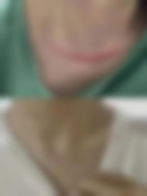 求美者真实反馈