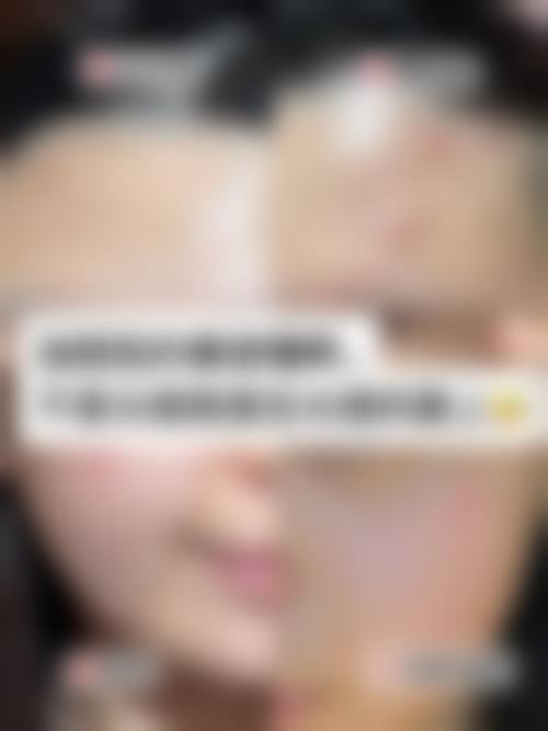 李德医生：依托精良设备的特色治疗方案