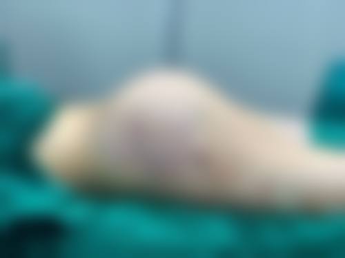 如何预约王乃立医生的面诊服务