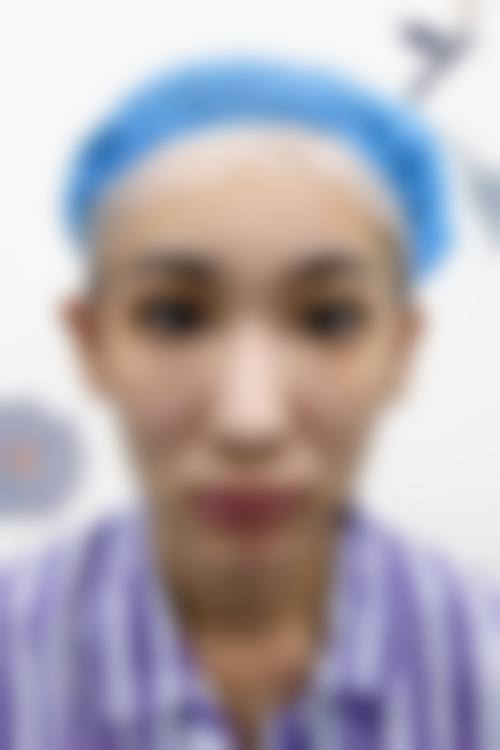 如何预约赵延峰整形的面诊服务