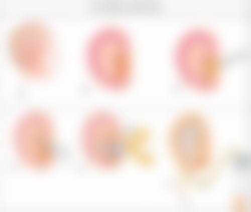 徐州安妮儿妇产医院大韩医学整形美容中 心特色项目及技术优势