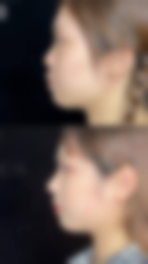 王乃立的个性化医美定制理念