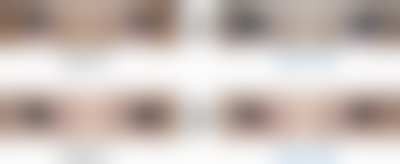 金镇英医生的特色医美技术亮点