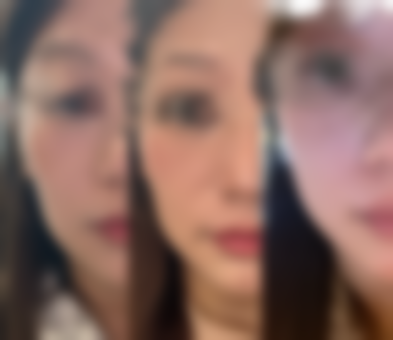 北京伊美尔紫竹整形医疗美容门诊部求美者反馈