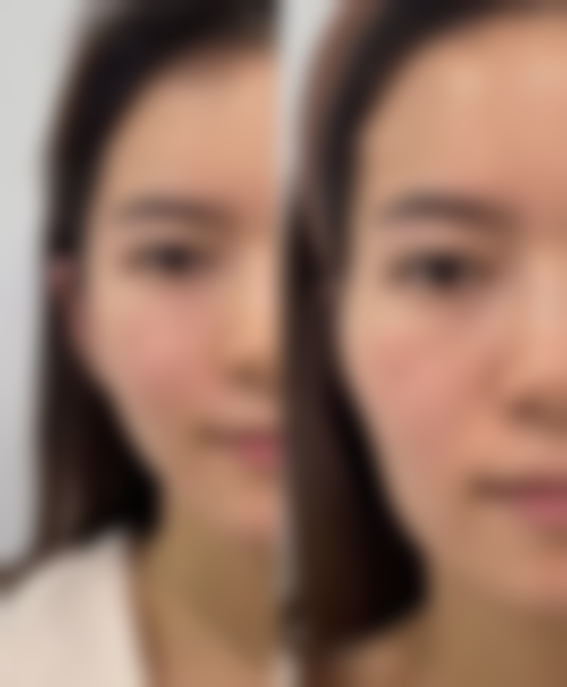 大同京城皮肤病医院特色项目及技术优势