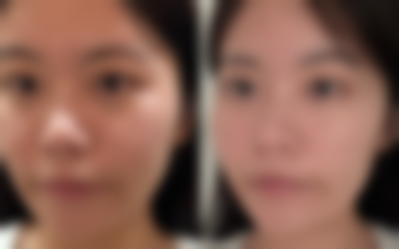 徐州安妮儿妇产医院大韩医学整形美容中 心价格收费