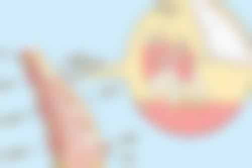 Medconsult Clinic Thailand求美者反馈