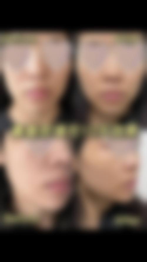 河范埈医生的个性化医美服务理念