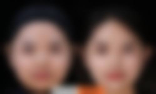 依托国内外精品设备，筑牢手术安心与成效双保护