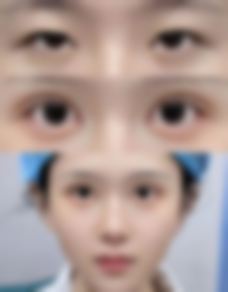 温岭市第四人民医院求美者反馈