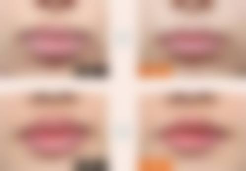 南充韩美整形医院价格收费