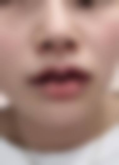 南充韩美整形医院特色项目及技术优势