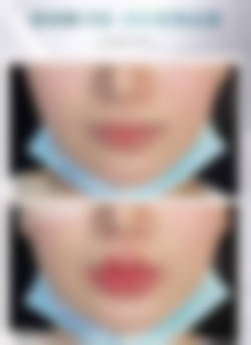 南充韩美整形医院来院路线