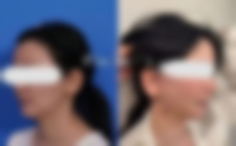 广州紫馨整形美容医院求美者反馈