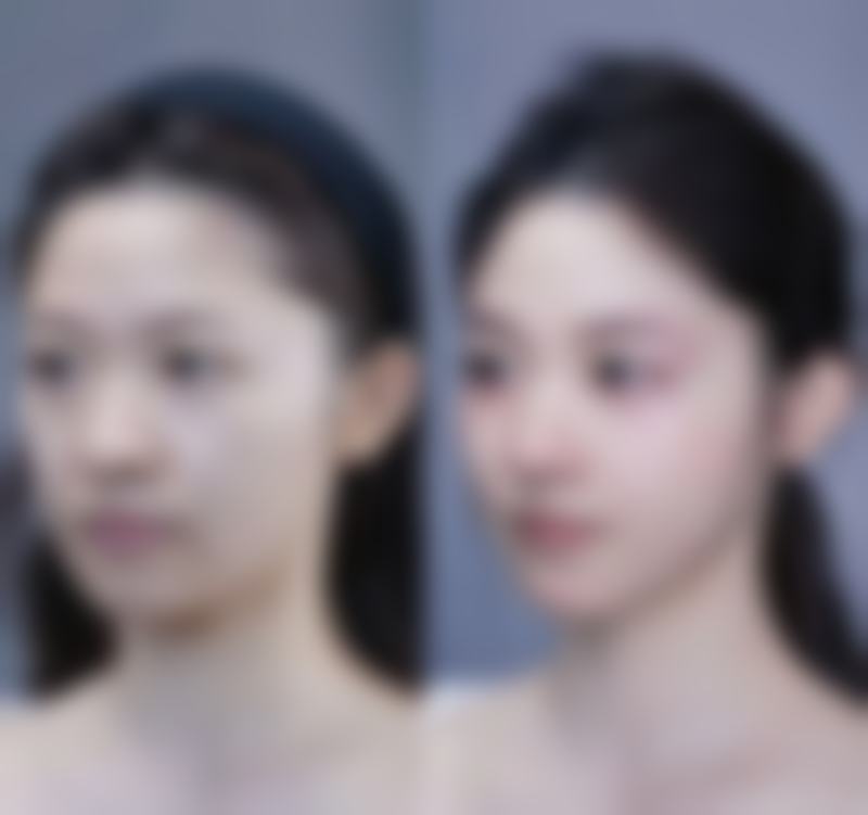 徐州艾优美紫馨整形医院特色项目及技术优势