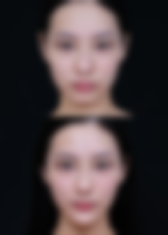 济南梦圆于氏整形医院价格收费