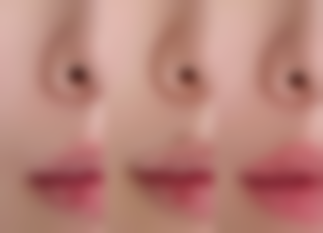 济宁任城壹美天成医疗美容医院价格收费