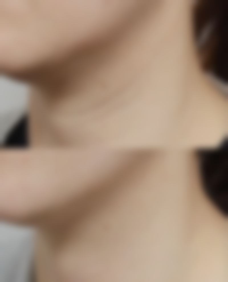 徐州艾优美紫馨整形医院求美者反馈