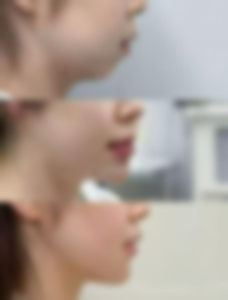 成都驻颜医学美容医院价格收费