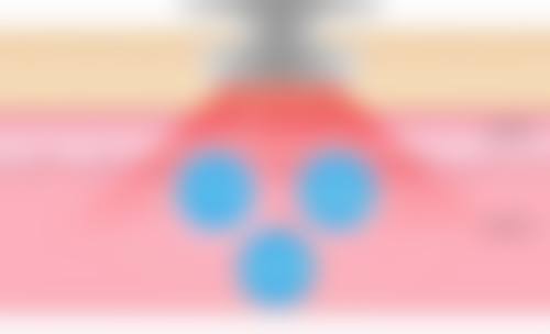 甘肃武威鑫涞美医疗美容特色项目及技术优势