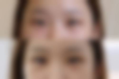 正规透明的医美收费与服务保护