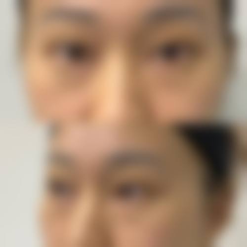 石家庄陈潮美容整形外科医院价格收费