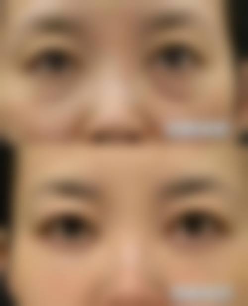 佛山和本医疗美容门诊部求美者反馈