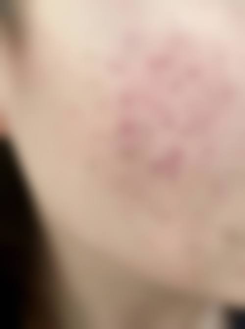 常建民医生主导的皮肤疾病诊疗服务