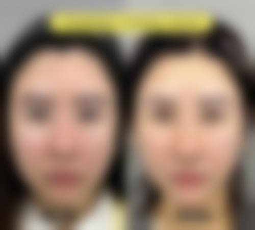 张清峰医生的个性化诊疗思路