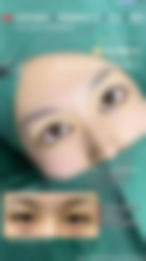 新乡亚星智美医疗整形美容医院求美者反馈