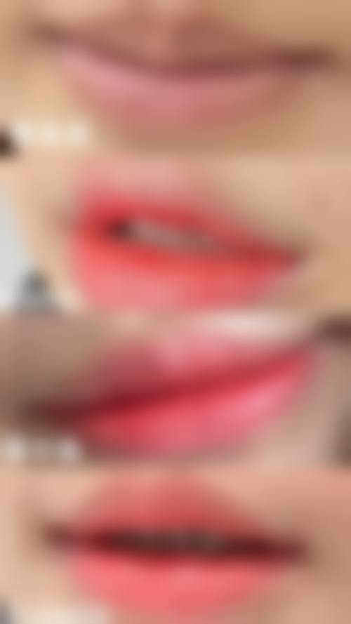 深圳龙翔医院价格收费