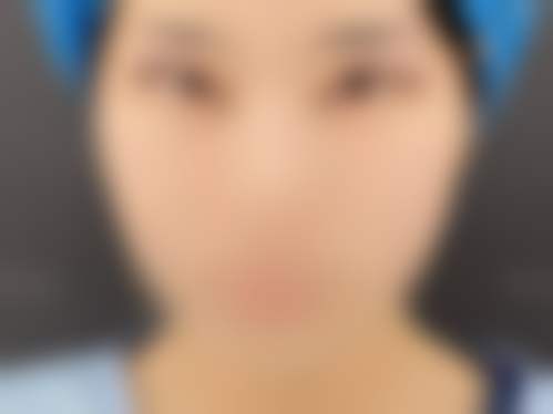 东阳馨丽莱整形医院求美者反馈