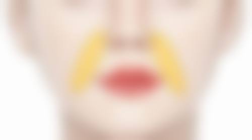 成都高新汇锦玛恩医疗美容诊所求美者反馈