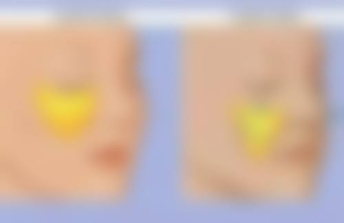 武汉诗美尔整形医院来院路线