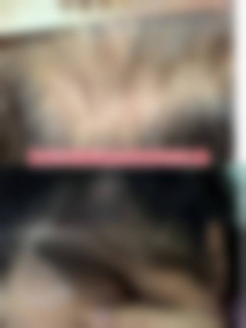 洛阳未毛种植医疗美容诊所价格收费