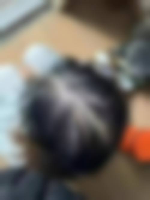 洛阳未毛种植医疗美容诊所特色项目及技术优势