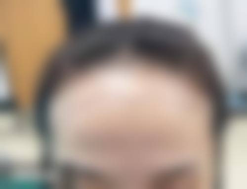 洛阳未毛种植医疗美容诊所求美者反馈