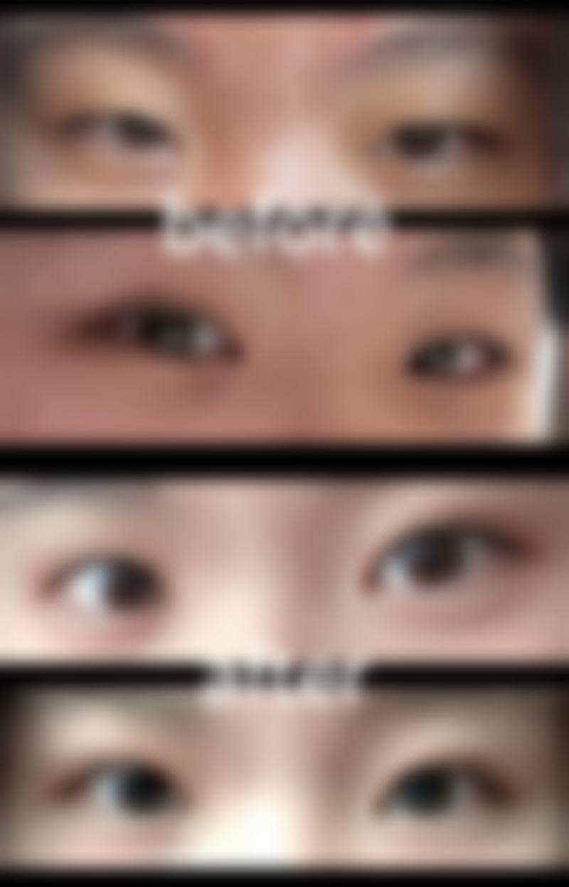 龙岩伊颜整形医院价格收费