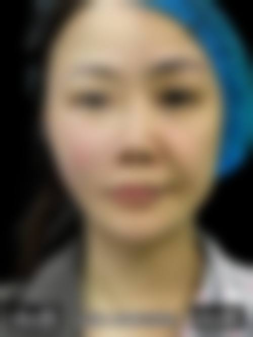 蒙自雕美人医疗美容诊所求美者反馈