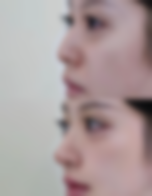 日本川崎整形医院求美者反馈