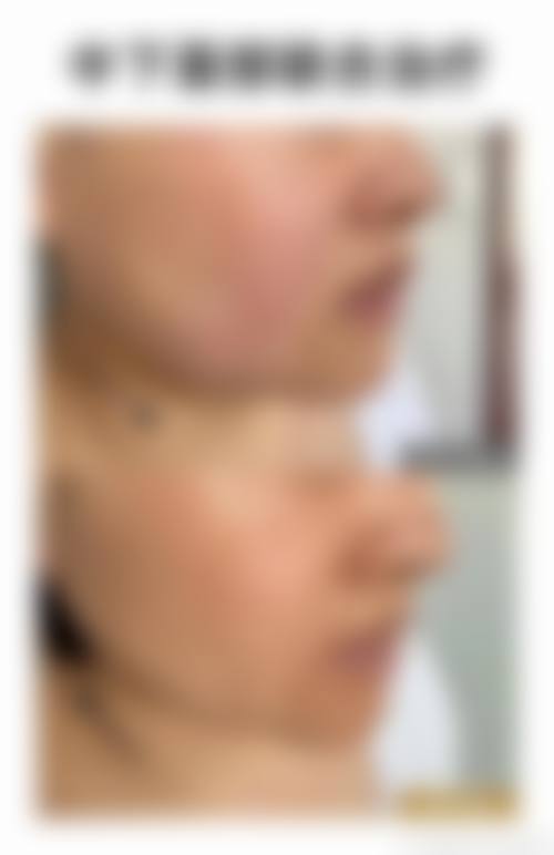 珠海伊斯美医疗整形医院求美者反馈