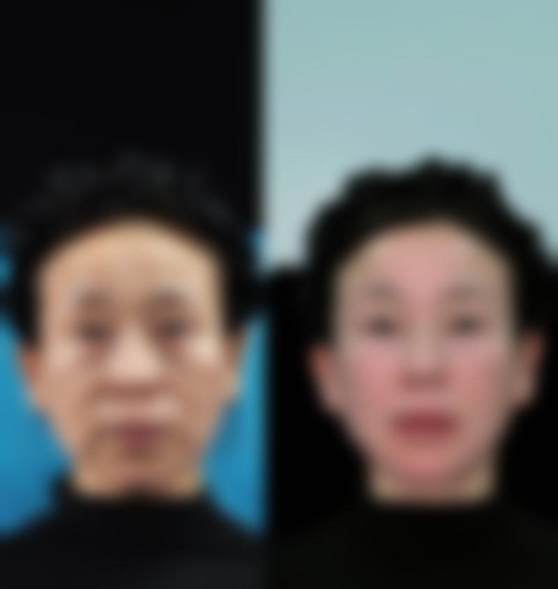 泰安佰瑞德美医疗美容诊所求美者反馈