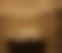 广东东莞缔美医疗美容医院特色项目及技术优势