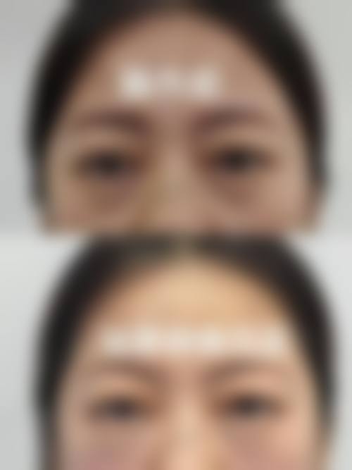 郑州瑞莱美医疗美容求美者反馈